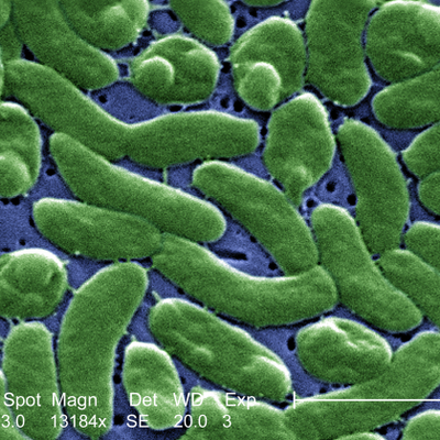 Vibrio vulnificus Bakterien, CDC (Public Health Image Library, PHIL)