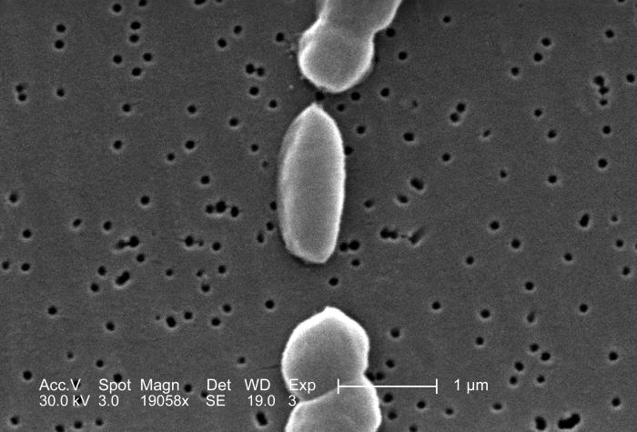 Vibrio parahaemolyticus Bakterien, Aufnahme mit einem Elektronenmikroskop